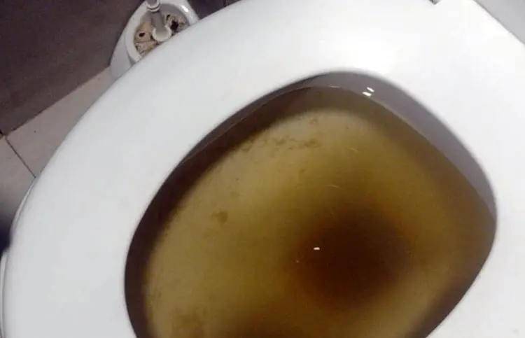 Desentupimento de Vaso: emergência - Ação Desentupidora: seu vaso entupiu e precisa de uma desentupidora 24 horas? Acabou de encontrar!